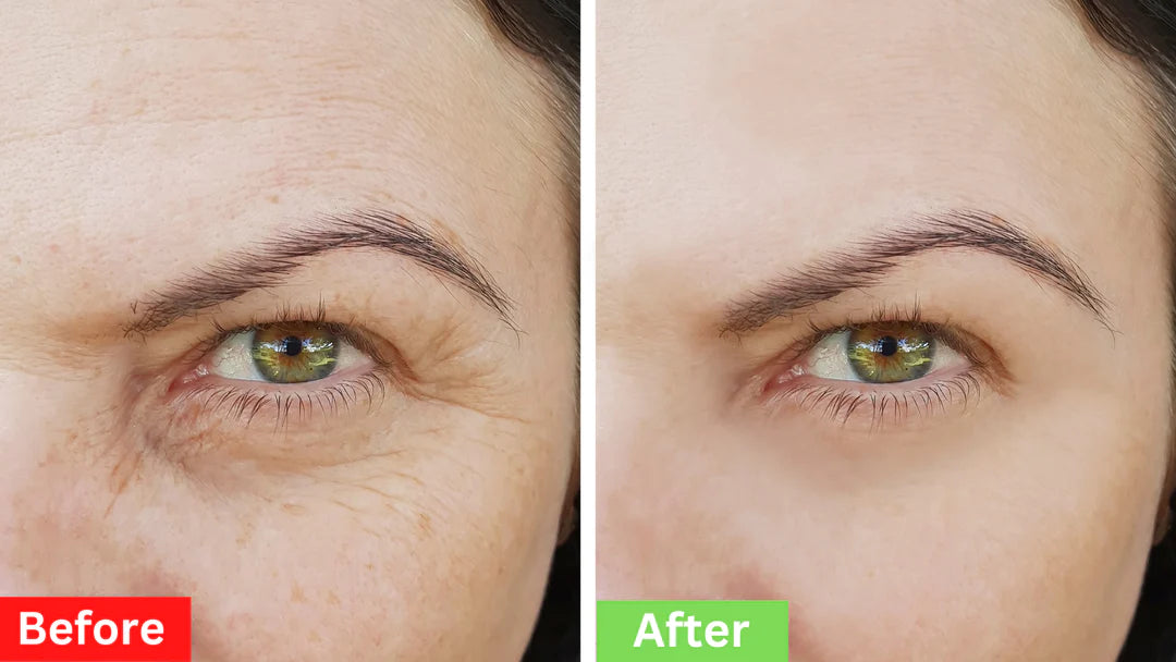 Berbax Instant Firm Eye Tightening Cream