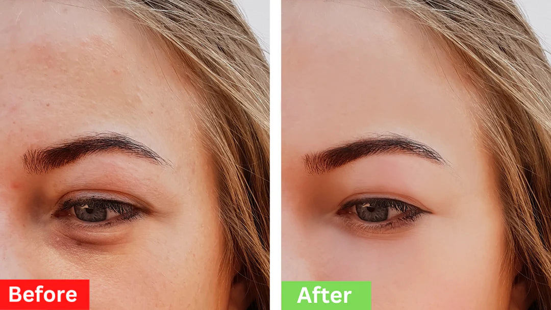 Berbax Instant Firm Eye Tightening Cream